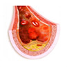 WP4. Endothelial function and vascular regeneration